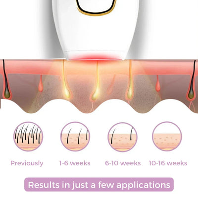 IPL Hair Remover