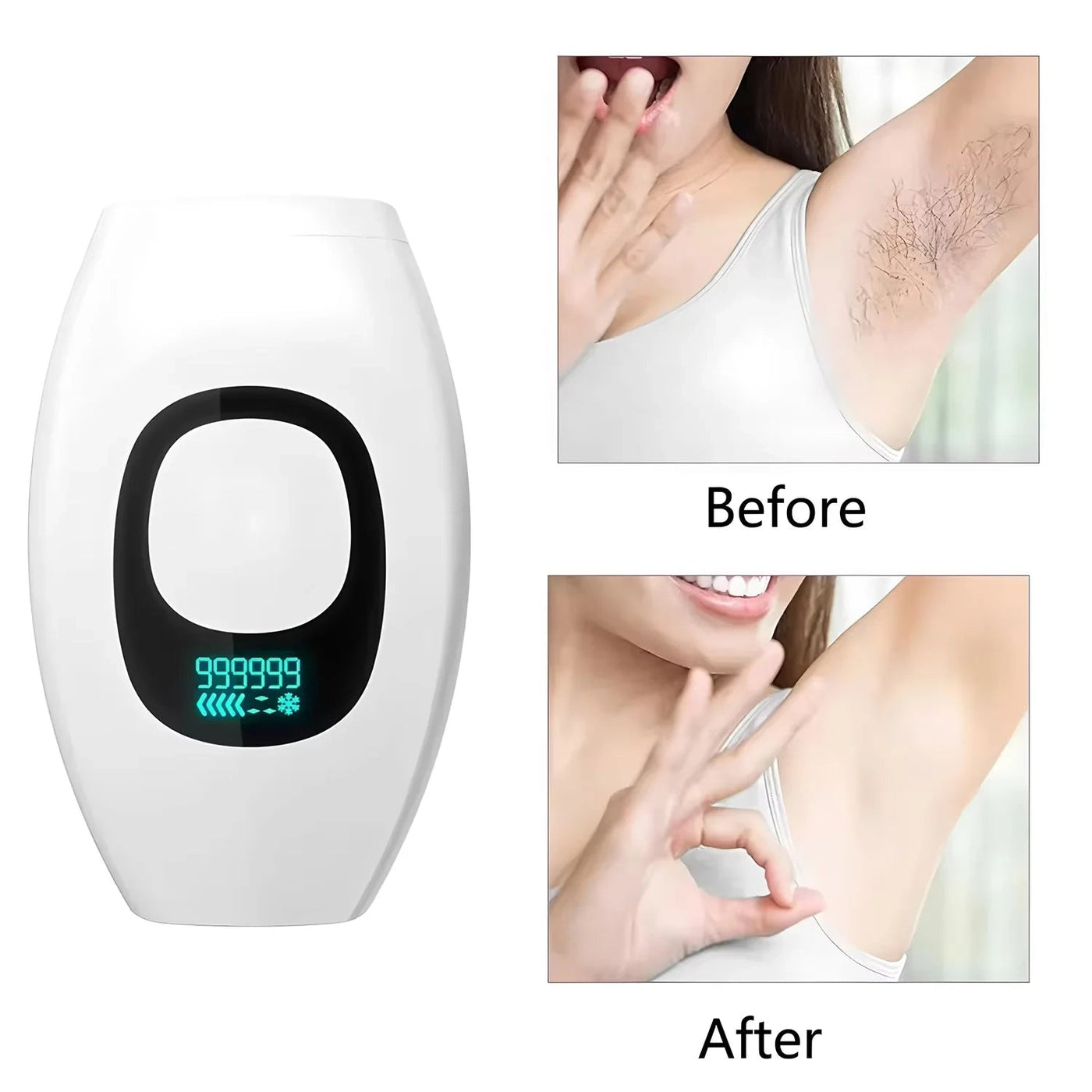 IPL Hair Remover