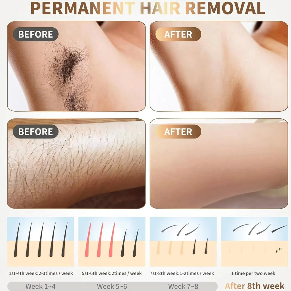 IPL Hair Remover